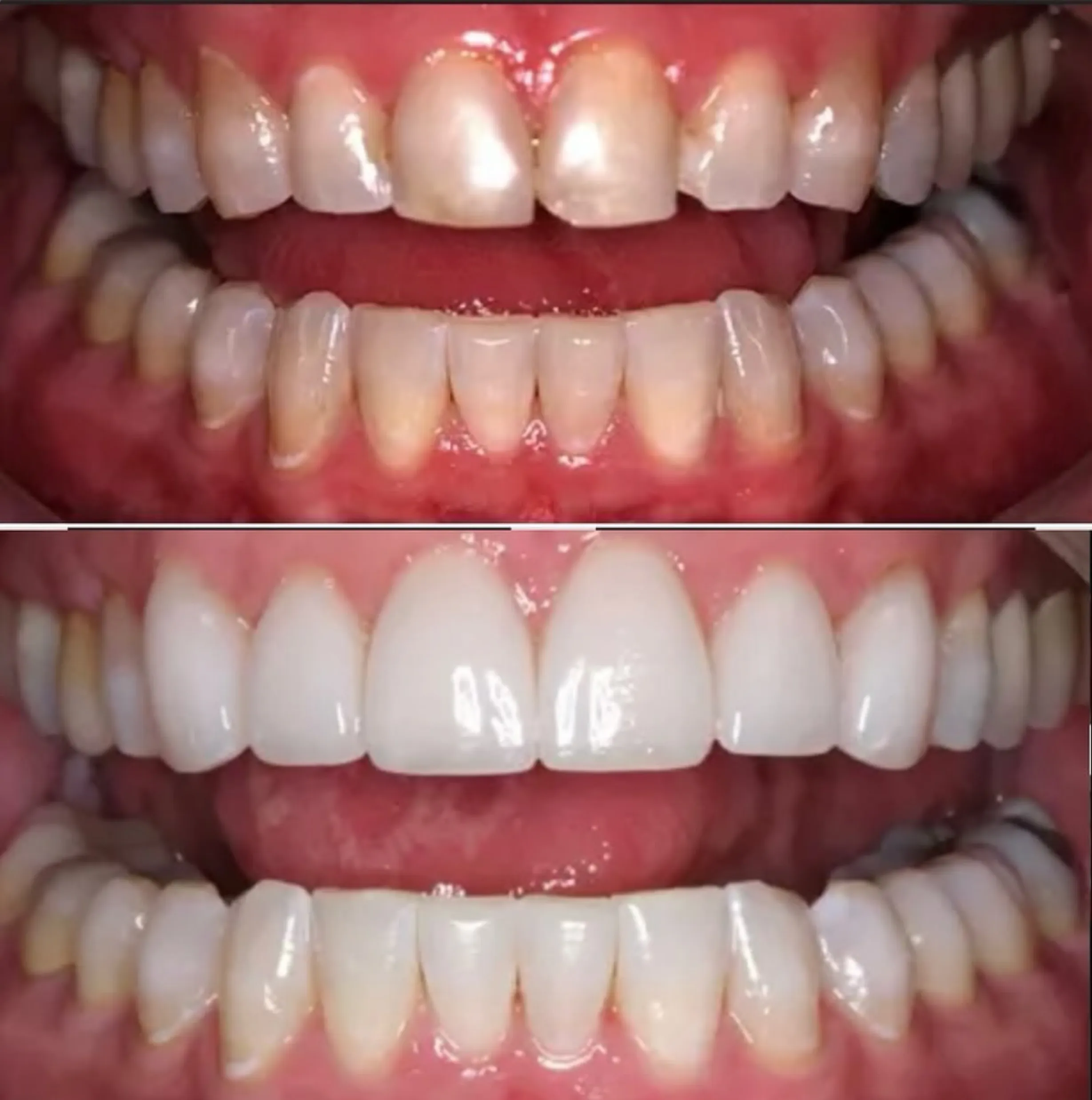 beauty industry whitening training