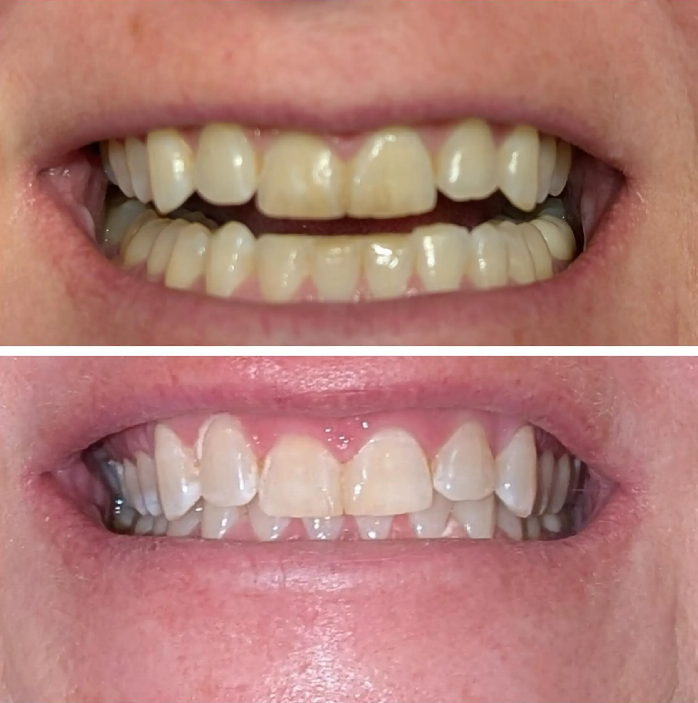 cosmetic whitening training modules