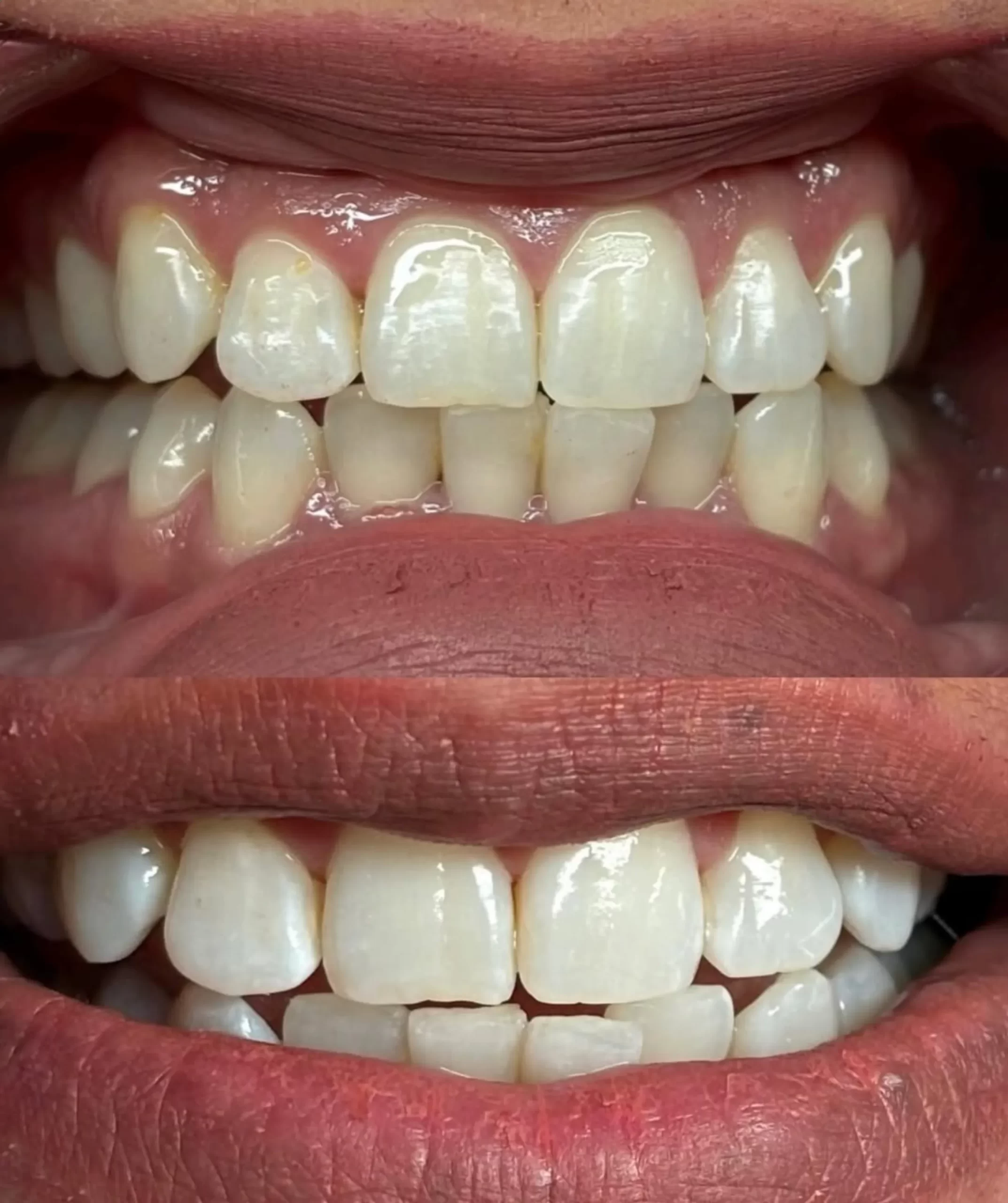 hands-on whitening course