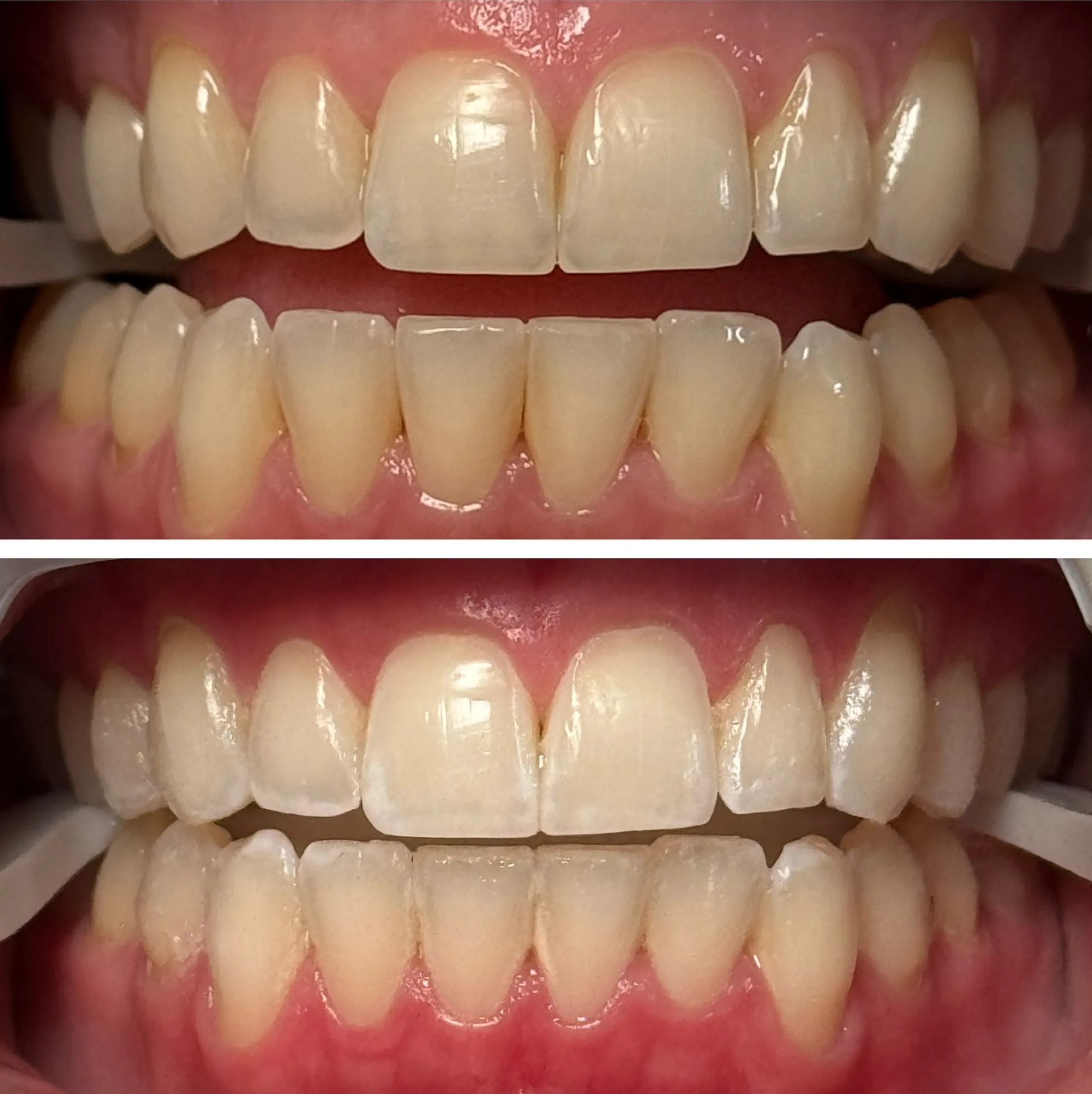 teeth whitening certificate Australia