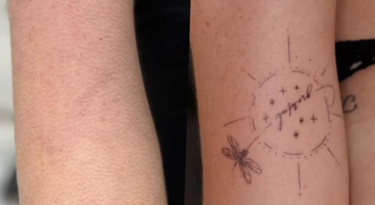 cosmetic tattoo artist tattoo removal