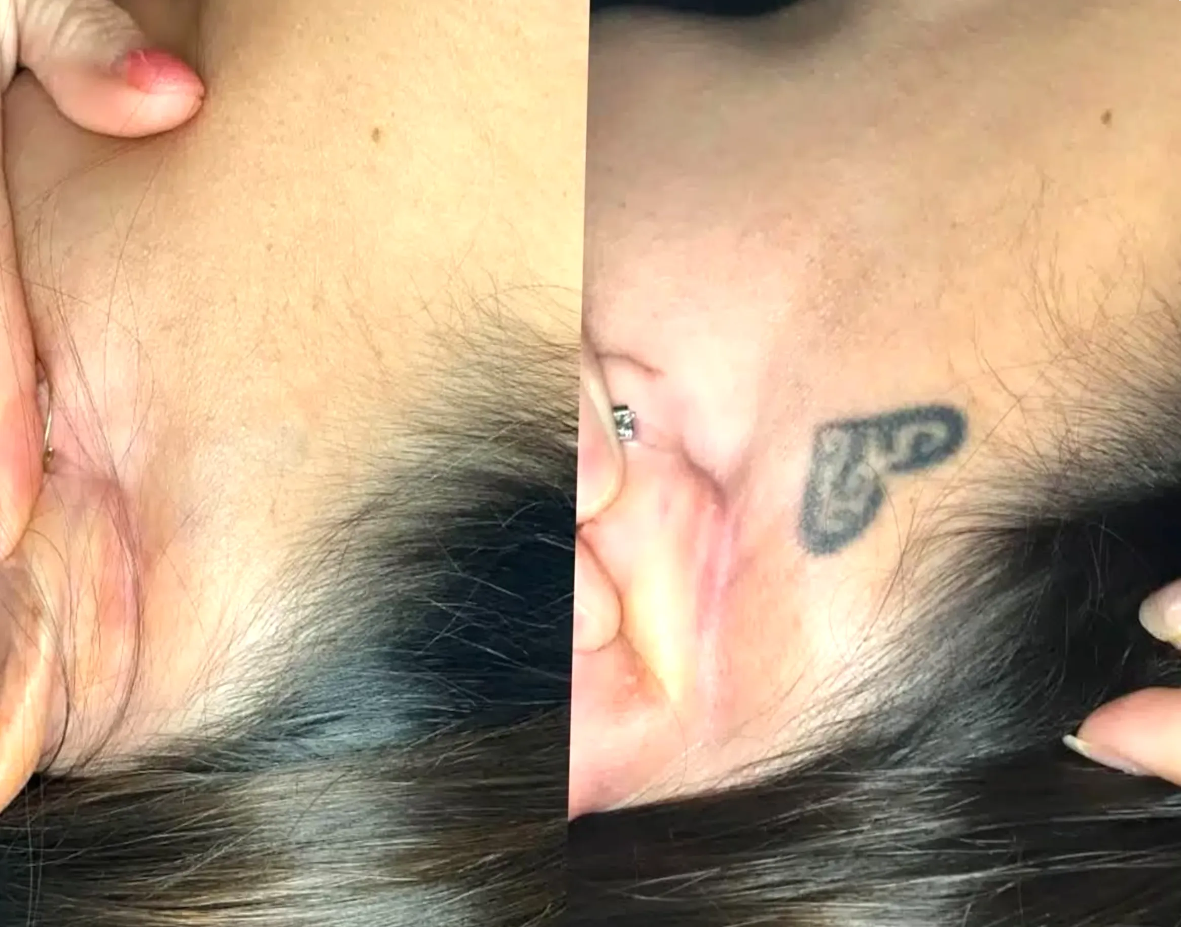 cosmetic tattoo correction training